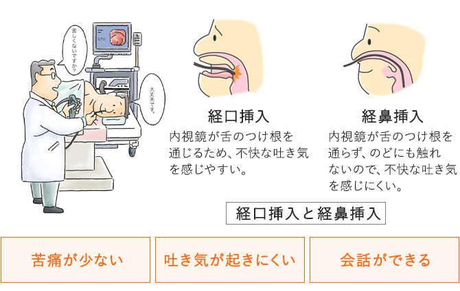 経口挿入　経鼻挿入　苦痛が少ない　吐き気が起きにくい　会話ができる